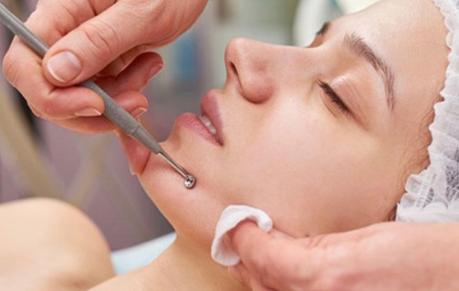 Limpieza Facial Profunda + Extracciones en microcentro caba